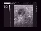 Ultra Sound 09.02.2009